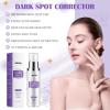HANYWIL Dark Spot Remover for Face & Body Serum,Rapid Tone Repair Cream with Hyperpigmentation Treatment,Sun Spot, Age Spot & Melasma Remover,Dermatologist-Tested Brightening Retinol Serum (1.7 Fl Oz) view 2