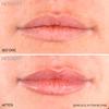 MesoLyft Lips 5 ML (5 ML) Lip Plumper view 3