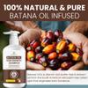 Beadlamey  Root Activator Batana Oil Hair Growth Shampoo: Natural Hair Loss Shampoo for Thinning Hair for Women and Men - Daily Hair Care at Home - 10.1 fl.oz view 2