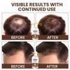 Beadlamey  Root Activator Batana Oil Hair Growth Shampoo: Natural Hair Loss Shampoo for Thinning Hair for Women and Men - Daily Hair Care at Home - 10.1 fl.oz view 4