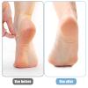 4 Pcs Moisturizing Gel Heel Socks Moisturizing Heel Repair Socks Toeless Socks Heel Protector for Cracked Heel Padded Sleeve Socks for Women Men Foot Care (Complexion) view 4