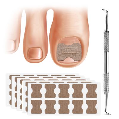 FERYES 50 PCS Breathable Ingrown Toenail Corrector Patch with Double-Ended Stainless Steel Toenail Lifter  Comprehensive Toenail Care Solution