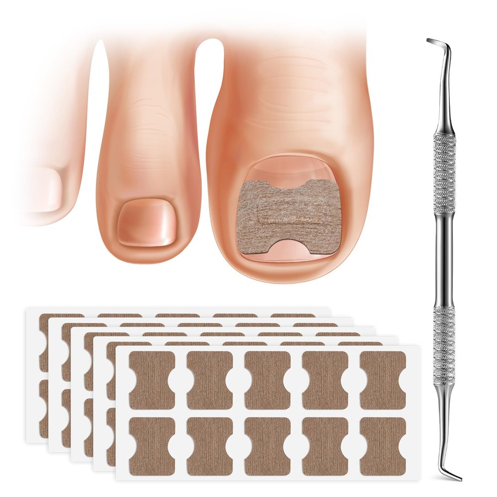 FERYES 50 PCS Breathable Ingrown Toenail Corrector Patch with Double-Ended Stainless Steel Toenail Lifter Comprehensive Toenail Care Solution