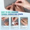 FERYES 50 PCS Breathable Ingrown Toenail Corrector Patch with Double-Ended Stainless Steel Toenail Lifter  Comprehensive Toenail Care Solution view 3