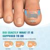 FERYES 50 PCS Breathable Ingrown Toenail Corrector Patch with Double-Ended Stainless Steel Toenail Lifter  Comprehensive Toenail Care Solution view 4