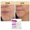 Premium Pimple Patch (36 counts) | Jekyll Brand Cosemtics | Hydrocolloid | Invisible | Acne Patch for Covering Zits and Blemishes | Sterile Spot Patches for Face and Skin | Dermatologist Approve view 2