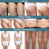 CRYOACTIVE Slim Body Contour Gel for Firmer Skin - Anti-cellulite for Men & Women - Tightening Gel for Tummy, Hips and Buttocks view 4