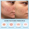 Dr. Alies - Professional Hydrocolloid Acne Pimple Patch - 144 Dots | Fast Healing Spot Stickers for Zits and Blemishes | Vegan and Cruelty-Free | Skin and Face Care view 2