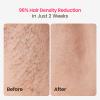 Laser Hair Removal, 25J Energy Triple-Pulse IPL Laser Hair Removal for Women, 12 cm Comfort Sapphire 37 F Ice-Cooling Contact, Hair Removal Device for Armpits Legs Arms Bikini Line view 3