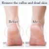 JIEYAO Stainless Steel Foot File, Metal Foot Scraper, Professional Foot File Callus Remover Double-Sided Foot Rasp Scrubber Pedicure Foot Care Tools for Wet & Dry Skin Heel Grater for Feet view 4