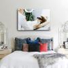 LHGVQXZA Beauty Salon Hair Removal Poster Beauty Spa Decoration Poster Laser Hair Removal Poster1 Canvas Painting Wall Art Poster for Bedroom Living Room Decor 12x08inch(30x20cm), Frame-style view 4