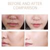2PCS Purifying Exfoliating Gel,Purifying Exfoliating Moisturizing Gel,Suitable for face and body use  view 4