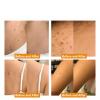 AAFQ Bee Venom Treament&Removal Cream,Face Moisturizers and Repair Skin for Men&Women,30ml (4) view 2