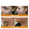 AAFQ Bee Venom Treament&Removal Cream,Face Moisturizers and Repair Skin for Men&Women,30ml (4) view 3
