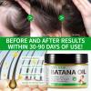 Raw Batana Oil for Hair Growth, 100% Pure Batana Oil from Honduras, Prevents Hair Loss, Repairs Damage, and Enhances Shine, Promotes Thicker, Healthier Hair for Men & Women, 4.2 oz view 2