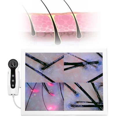 Skin Hair Scalp Detector Hair Follicle Facial Skin Oil Moisture 15 Inch HD LCD Screen Microscope Tester