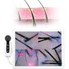 Skin Hair Scalp Detector Hair Follicle Facial Skin Oil Moisture 15 Inch HD LCD Screen Microscope Tester view 1