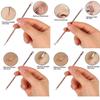 Euxor, Blackhead Remover Pimple Comedone Extractor Tool Best Acne Removal Kit - Treatment for Blemish, Whitehead Popping, Zit Removing for Risk Free Nose Face Skin with Case (Rose, 4 Piece Set) view 3