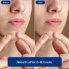 Chel's Magical Cosmetic Acne Pimple Patches | 66 Hydrocolloid Patches for Acne & Zit Treatment | Invisible Spot Cover for Blemishes & Breakouts | Korean Skincare, Safe for Sensitive & Acne-Prone Skin view 4