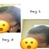 19-in-1 Hair Oil - Herbal growth oil for thicker hair view 3