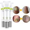 Nail Repair Cream for Nail,Nail for Toenail and Toenail for Nails The Instant Beauty Cream Nail Repair Essence Restores nail repair essence gel view 2