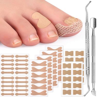 BLATOWN Ingrown Toenail Correction Treatment Tool, 64Pcs Breathable Ingrown Toenail Strips in 3 Types, No Glue Safe Ingrown Toenail Tool with 2 Pedicure Tools for Ingrown Toenail Remover