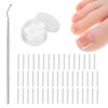 (50+1) Pcs Ingrown Toenail Treatment Corrector Set, Professional Pain-Free Ingrowns Toenails Removal Kit with Toenail Lifter, Toenail Strip for Men Women, Easy Fixed Ingrowns Toenails Tool view 1