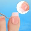 (50+1) Pcs Ingrown Toenail Treatment Corrector Set, Professional Pain-Free Ingrowns Toenails Removal Kit with Toenail Lifter, Toenail Strip for Men Women, Easy Fixed Ingrowns Toenails Tool view 3