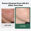 ERIGERON Soy Yogurt Cleanser, Facial Cleanser with Black Soybeans, Greek Yogurt Texture, Face Mask, Scrubber, Deep Pore Face Wash, Blackhead Remover, Korean SkinCare (3.38 fl.oz.) view 2