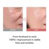 107% Crows Feet Improvement, 117% on Neck Lines & 109% on Nasolabial Lines  Boosts Elasticity  With Botulinum-Inspired Peptide and Collagen  Korean Skincare Koreas Best Skincare Stick Kioskin view 2