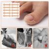 12 pcs Ingrown Toenail Strips, Painless Ingrown Toenail Corrector Breathable Nail Correction Patches Non-Woven Ingrown Nail Stickers for Professional Toenail Correction view 4