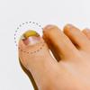 Ingrown Toenail Treatment & Corrector with Latex Elasticity - Curved Toenail Straightener | Effective Daily Solution for Ingrown Toenail Pain & Growth Correction [M/0.75inches/18-20mm] view 1