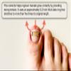 NinthAvenue Basics [XS/0.63inches/15-17mm] Ingrown toenail treatment by latex ring elasticity, usable in everyday life, Ingrown toenail corrector, Yellow/Silver view 2
