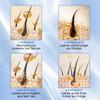 W3W Eyelash Growth Serum  Peptide Lash Enhancer for Longer, Thicker Lashes & Brows  Clinically Proven Natural Botanical Formula with Myristoyl Pentapeptide-4 & Helichrysum Extract (4ml) view 4