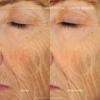 philosophy ultimate miracle worker nourish & rejuvenate face & neck cream 2 fl oz view 4