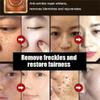 2024 New Anti-Blemish Anti-Aging Anti-Wrinkle Tear-Off Mask, Exfoliating Mask For Pore Cleansing, Peel Off Mask, Facial Mask Peel Off (4PCS) view 4
