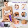 BLITZWAX Hair Removal Waxing Kit with 14oz Lavender Waxing Beads for Sensitive Face, Legs, and Body, 180 Accessories Ideal for Women Men at Home Salon, Beginner Friendly, Quick Heating view 3