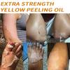 Yellow Peeling Oil For Dark Skin - Natural Formula Exfoliating Peels Solution, Exfoliating Peeling Solution For Body, Hand, Feet And Face All Skin Type view 4