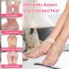 XANGNIER 100 Pairs Disposable Moisturizing Socks for Dry Cracked Feet Women,Foot Gloves for Moisturizing,Plastic Foot Covers for Feet,Moisturizing Foot Mask Exfoliating Disposable Pedicure Socks view 2