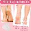 XANGNIER 100 Pairs Disposable Moisturizing Socks for Dry Cracked Feet Women,Foot Gloves for Moisturizing,Plastic Foot Covers for Feet,Moisturizing Foot Mask Exfoliating Disposable Pedicure Socks view 3
