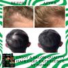 AKBAN Batana Oil for Hair Growth, with Rosemary Oil Maca Argan Jojoba Oil, Promotes Hair Thickness, Nourish Scalp and Hair for All Hair Tapes | Glass Bottle with Dropper | 1fl oz + 1 fl oz view 3