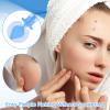 AOZUO 100PCS Disposable Blackhead Blemish Remover, Sterile Pimple Needles Pimple Popper Needles Tool for Acne, Whitehead, Closed Mouth Comedone Removal Clear Skin Suitable for Beauty Salon and Home view 2