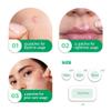SoloVegan 55Count Don't Pop to Me Blemish Patch, Invisible Spot Cover, Hydrocolloid Acne Patch, Treatment for Breakouts, Absorbs Zits & Blemish, Korean Skin Care (165pcs (3PK)) view 4