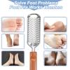 Professional Foot Scrubber Dead Skin Remover, Pedicure Foot File Callus Removal, Heel Scraper for Cracked Heels, Microplane Cheese Grater for Feet, Foot Rasp for Hard Skin(T1) view 3
