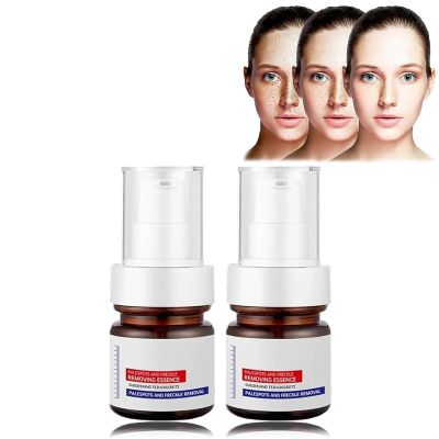 and Removing Essence, 30ml - Face Serum, Vitamin C Serum for
