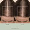 VEGAMOUR GRO+ Advanced Hair Serum for Improving Hair Density, Reduces Shedding and Promotes a Healthy Scalp, 3 pack view 3