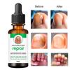 NinthAvenue Basics Nail serum for nail repair, fungal infection, anti-infective removal, 100% Natural Profesional 30 ML Serum For Nail Strong, Supple and Shaped Nail Care Serum (30ML PACK OF 2) view 2