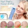 ANSIOVON Blue Light Therapy Device for Acne Spot Treatment - LED Acne Blue Light Therapy Wand for Face view 2