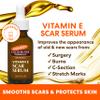Palmer's Vitamin E Mom's Skin Healing Body Care Kit, Pregnancy and Postpartum Essentials Includes Body Oil, Scar Serum and Concentrated Body Cream view 4