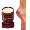 Juanita's Supply Company Anti-Fungal Foot Repair Cream Ultimate Solution Healthy Feet Dead Skin Removal Peeling Moisturizing Exfoliation Foot Care Repair For Cracked Heels Natural Organic Moisturizer view 2